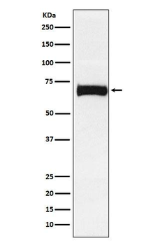 Nectin 2 Rabbit mAb