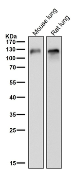 CD146 Rabbit mAb