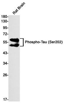Phospho-Tau (Ser202) Rabbit mAb