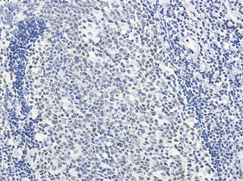 HMGB2 Rabbit mAb