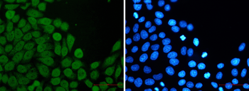 eIF4A3 Rabbit mAb