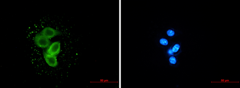 Meckelin Rabbit mAb