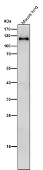 SPINK5 Rabbit mAb