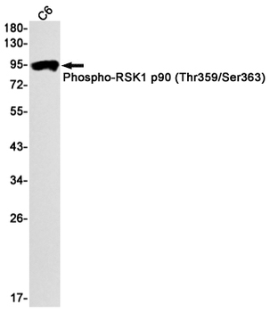 Phospho-RSK1 p90 (Thr359/Ser363) Rabbit mAb