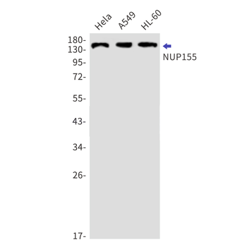NUP155 Rabbit mAb