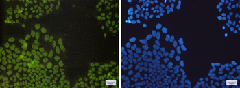 Nrf1 Rabbit mAb