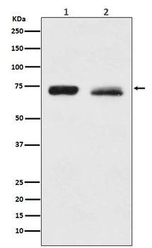 NF2 Rabbit mAb