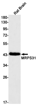 MRPS31 Rabbit mAb