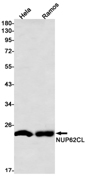 NUP62CL Rabbit mAb