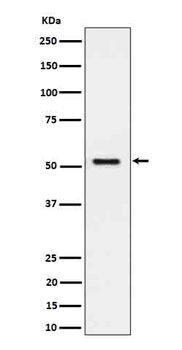 SEC62 Rabbit mAb