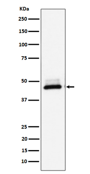 DNAJA4 Rabbit mAb
