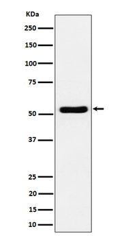 GPRC5B Rabbit mAb
