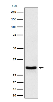 FRAT1 Rabbit mAb