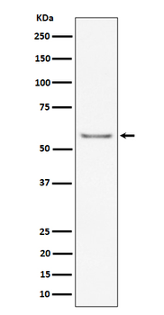 ICAM2 / CD102 Rabbit mAb