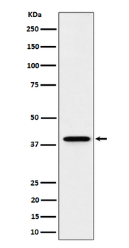 DCAF7 Rabbit mAb