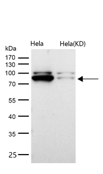 CLPTM1 Rabbit mAb [KD Validated] Antibody