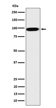 CLPTM1 Rabbit mAb [KD Validated] Antibody