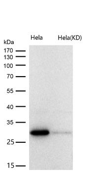 BRMS1 Rabbit mAb [KD Validated]