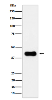ACAA2 Rabbit mAb [KD Validated] Antibody