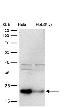 CIRBP Rabbit mAb [KD Validated]