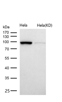 AP1G1 Rabbit mAb [KD Validated] Antibody