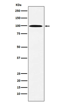 AP1G1 Rabbit mAb [KD Validated] Antibody