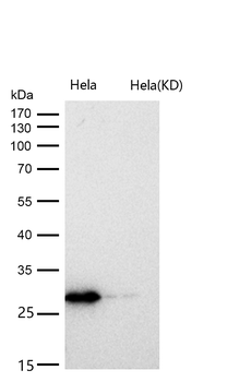 CHMP2B Rabbit mAb [KD Validated]
