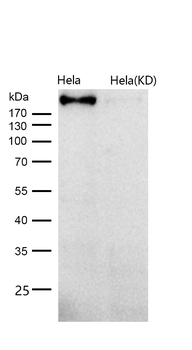 RhoGAP Rabbit mAb [KD Validated] Antibody