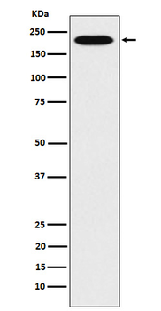 RhoGAP Rabbit mAb [KD Validated] Antibody