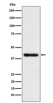 TMOD2 Rabbit mAb