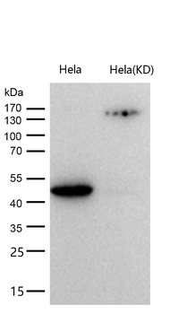 CSK Rabbit mAb [KD Validated]