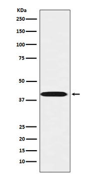 LHX3 Rabbit mAb