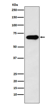 SAM68 Rabbit mAb