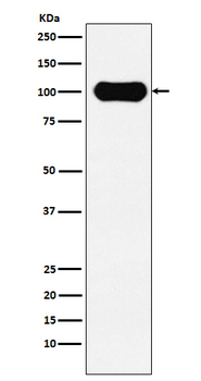 FE65 Rabbit mAb [KD Validated] Antibody