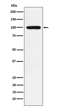 Calmegin Rabbit mAb [KD Validated] Antibody