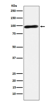 Calmegin Rabbit mAb [KD Validated] Antibody