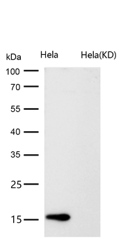 CDKN2C Rabbit mAb [KD Validated]