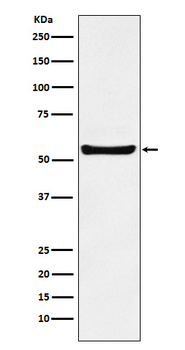 PAR2 Rabbit mAb