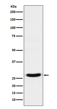 TCF21 Rabbit mAb
