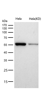 CBX2 Rabbit mAb [KD Validated]