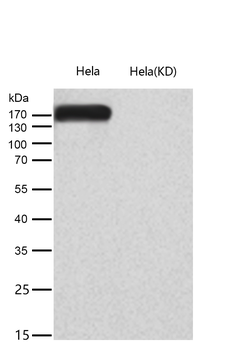 EHMT2/G9A Rabbit mAb [KD Validated]