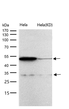 CD97 Rabbit mAb [KD Validated] Antibody
