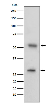 CD97 Rabbit mAb [KD Validated] Antibody