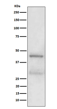 MBD2 Rabbit mAb