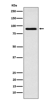 RSK4 Rabbit mAb