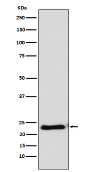 RAIDD Rabbit mAb