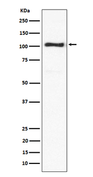 ACTN3 Rabbit mAb