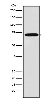 Plastin L Rabbit mAb
