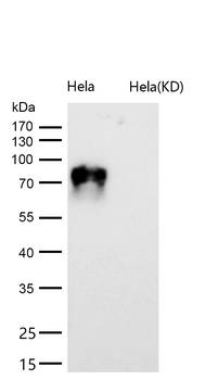 CD166 Rabbit mAb [KD Validated] Antibody
