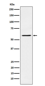 PAK1 Rabbit mAb
